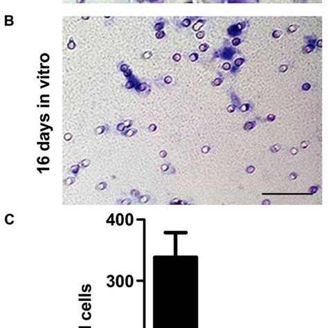 Microglia morphology changes from amoeboid to a more ramified shape... | Download Scientific Diagram