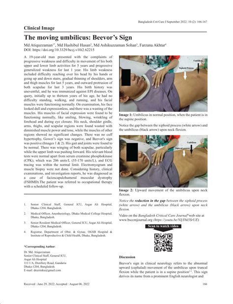 (PDF) Clinical Image The moving umbilicus: Beevor's Sign