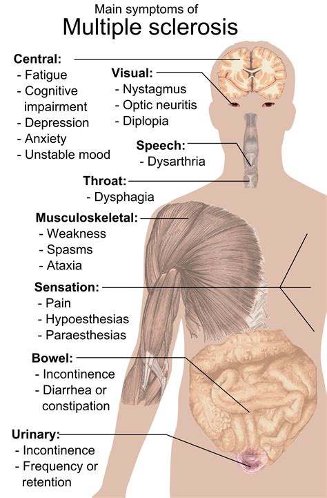 View 10 Multiple Sclerosis Skin Rash - Nova Benelux