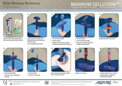 Updated Marrow Cellution™ Process Steps | Aspire Medical Innovation