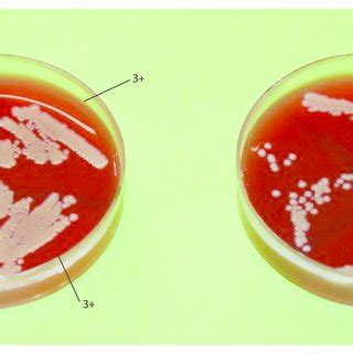 Columbia Agar base plates showing growth scores. | Download High ...