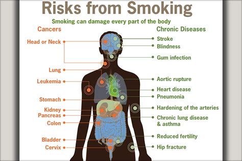 24"x36" Gallery Poster, health Risks from smoking cdc diagram cancer ...