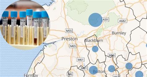 Chorley Hospital Map - Location Maps East Lancashire Hospitals Nhs Trust / From mapcarta, the ...