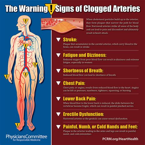 What Clogs Your Arteries The Most at Elizabeth Lowell blog