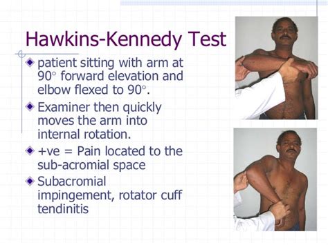 Shoulder examination