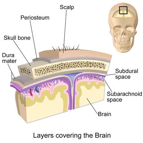 Subdural Haemorrhage | Intracranial Haemorrhage | Geeky Medics