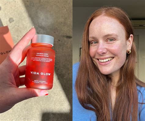 All the Details on Vida Glow’s Hair Supplement, From Someone Who Takes It Every Day