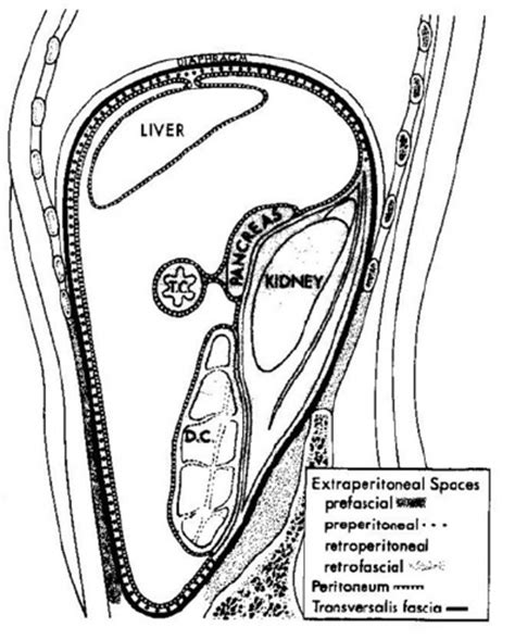 Extraperitoneal spaces | Download Scientific Diagram