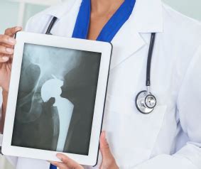 Lawsuit: Stryker Rejuvenate Hip Implants Cause Metal Blood Poisoning