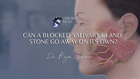 Can a blocked salivary gland stone go away on its own? - YouTube