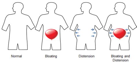 How to reduce bloating and anti-bloating drinks