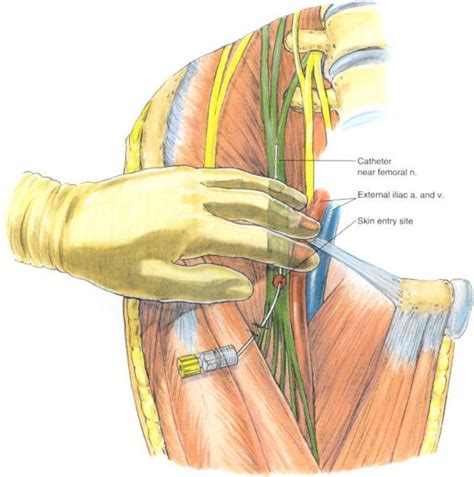 Pin by clifford60 on Anatomy | Femoral nerve, Pain management, Anatomy