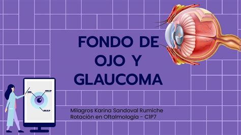 Fondo del ojo y glaucoma | Astrid Querevalú | uDocz