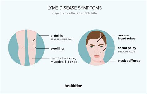 Lyme Disease: Symptoms, Treatment, and Prevention