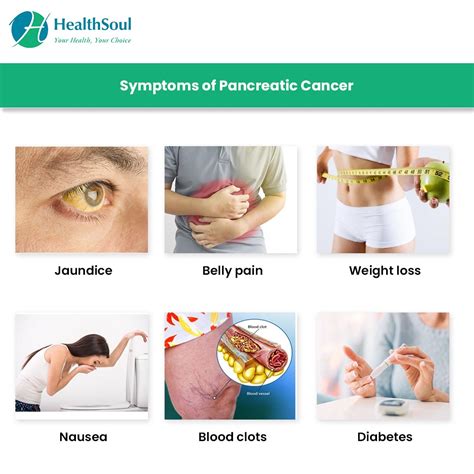 Pancreatic Cancer Signs