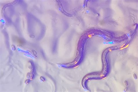 Eyeless roundworms sense color | MIT News | Massachusetts Institute of Technology