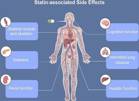 Reviews on Statin-Associated Side Effects | IntechOpen