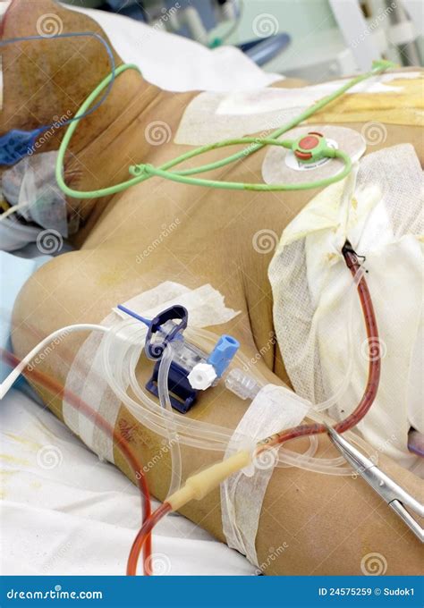 Patient in the ICU. Seriously Ill in Bed. Stock Image - Image of ...