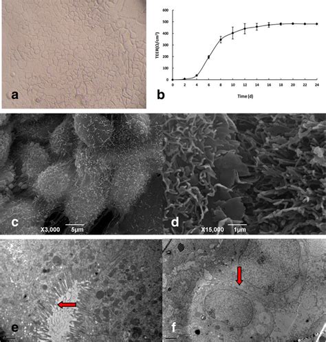 Morphology and characteristics of Caco-2 cell monolayer during and ...