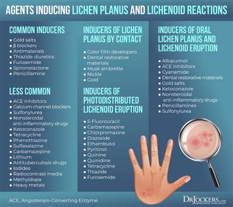 Lichen Planus: Symptoms, Causes and Support Strategies