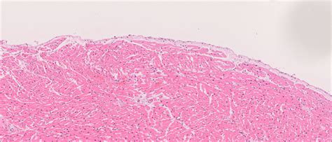 Endocardium Histology