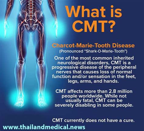 Charcot Marie Tooth Syndrome - Meulin