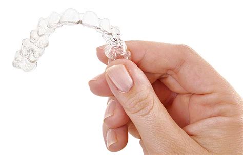 Invisalign Clear Aligners | Hayfield Dental Care | Alexandria Virginia