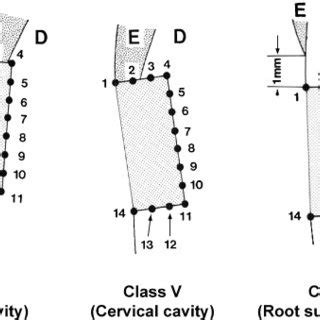 Three kinds of cervical restoration and each measured point in the... | Download Scientific Diagram