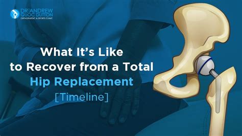 Total Hip Replacement Recovery [Timeline] | Dr Andrew Dutton