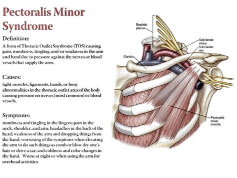 Pectoralis minor muscle - PT Master Guide