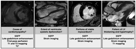 Practical Guide to Evaluating Myocardial Disease by Cardiac MRI | AJR