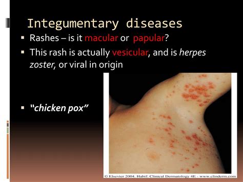 PPT - Selected Integumentary System Diseases & Conditions PowerPoint Presentation - ID:1846654