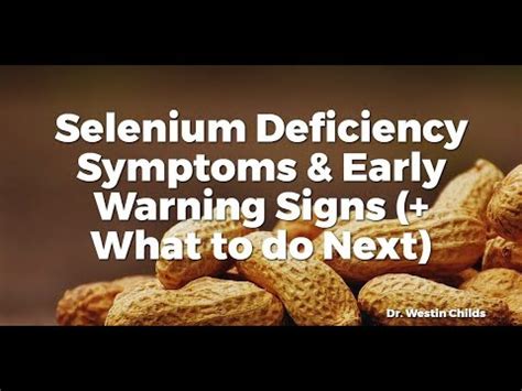 Selenium Deficiency Symptoms & Early Warning Signs (+ What to do Next) - YouTube