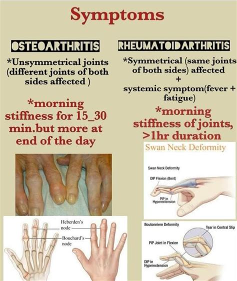 Symptoms Osteoarthritis and Rheumatoid arthritis