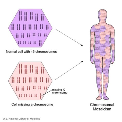 File:Chromosome- mosaicism.jpg - Embryology