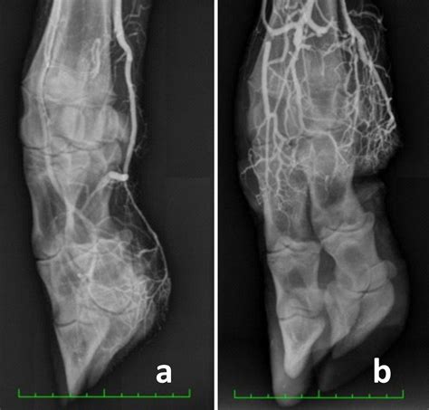 Fescue Foot Reported in Missouri Cattle | Drovers