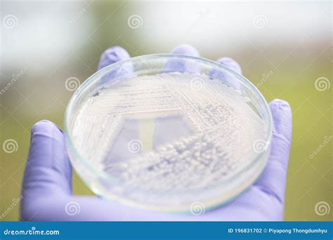 Yeast in Petri Dish for Education in Laboratories. Stock Photo - Image ...