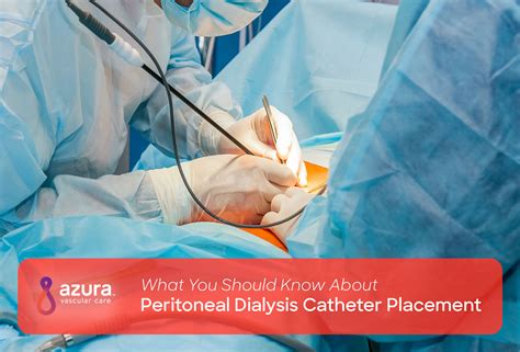 What to Know About Peritoneal Dialysis Catheter Placement