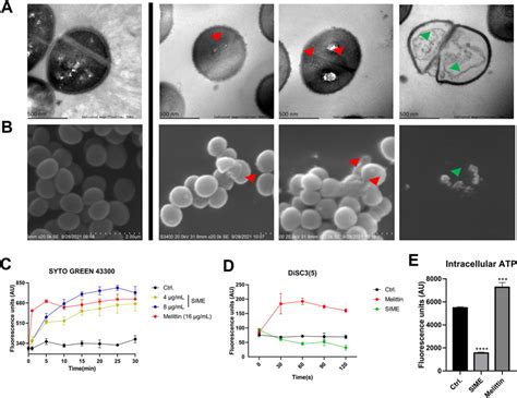 Mechanism of action by SIME.A Transmission electron microscopy images... | Download Scientific ...