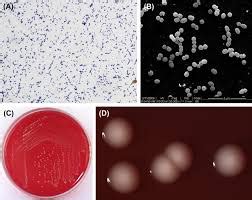 Peptostreptococcus anaerobius - microbewiki