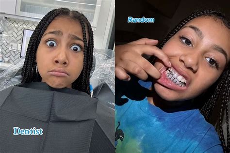 North West, 10, shows off her sparkling grill on TikTok... amid Kanye ...