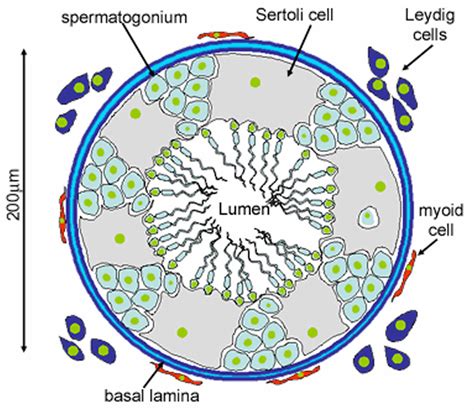 Leydig cell tumor causes, symptoms, diagnosis, treatment & prognosis