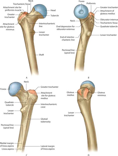 Extracapsular proximal femur fractures | Musculoskeletal Key