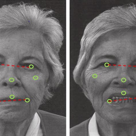 Facial expression-based model of the iPrognosis app for detection of... | Download Scientific ...