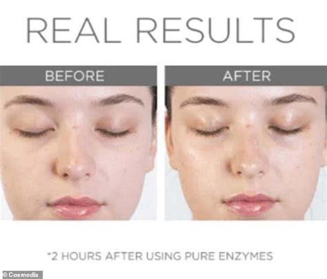 'Visibly glowing skin - in just 10 minutes!' Save 30% on an ...