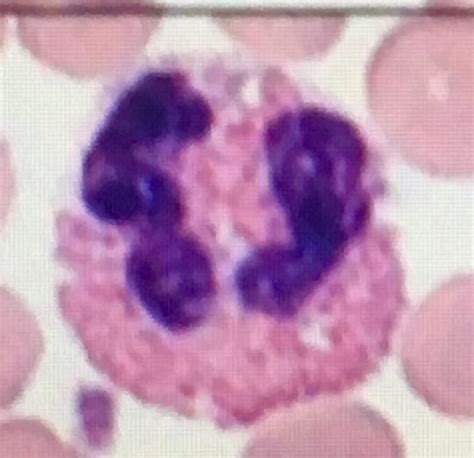 Eosinophil Count (Absolute Eosinophil Count) - Labpedia.net