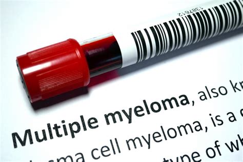 What are the signs of multiple myeloma? Symptoms and diagnosis