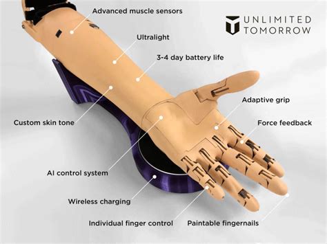 3D printed, ultralight, AI enhanced high tech prosthetic arms