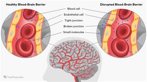 Blood-Brain Barrier: Definition, Related Conditions, and More