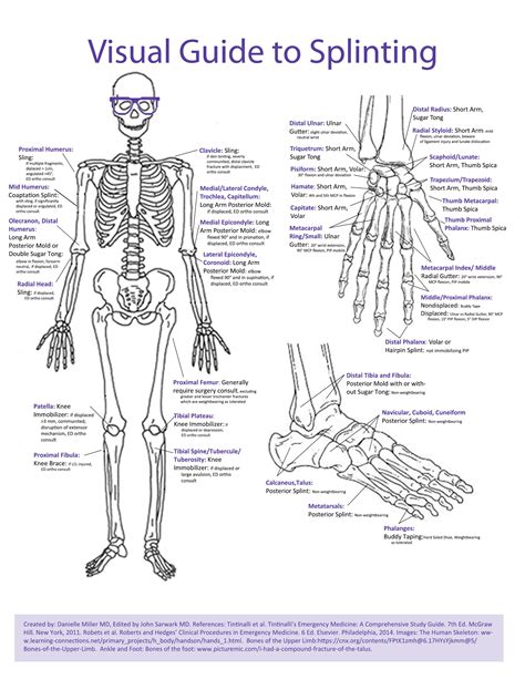 Visual Guide to Splinting — NUEM Blog